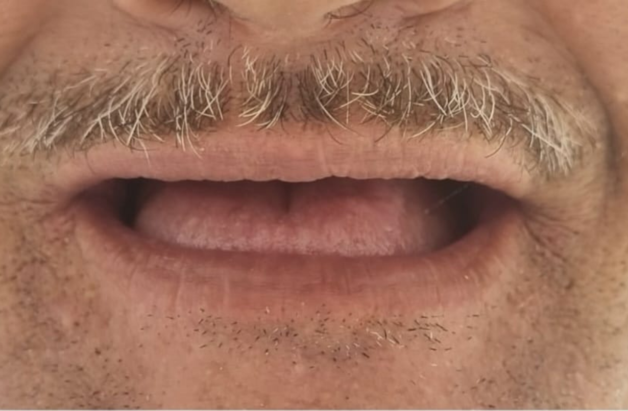 av 5